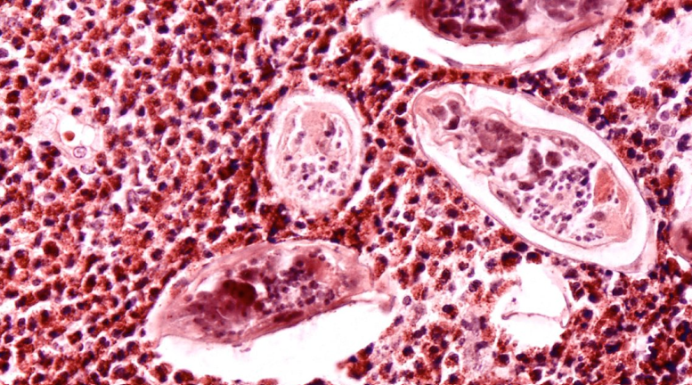 term image