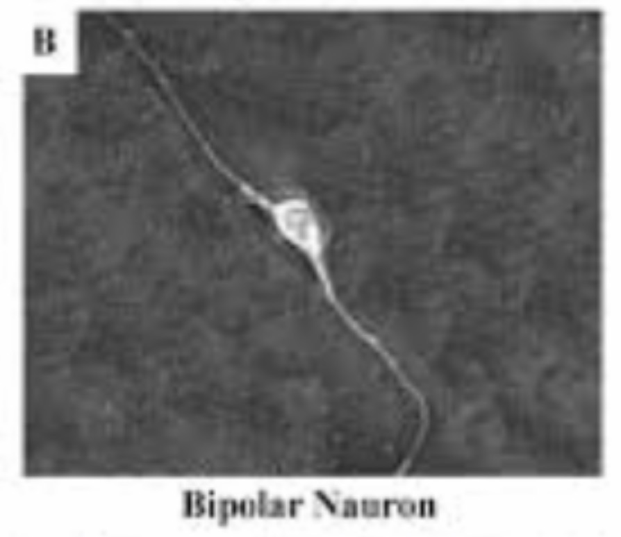 <p>Bipolar Neuron : Function : Carries sensory impulses for special senses like vision, smell, and hearing.</p>