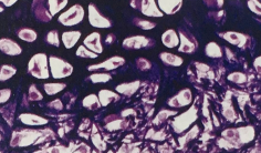 <p>Tipo de tejido cartilaginoso</p>