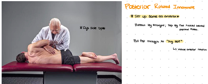 <ol><li><p><span style="background-color: transparent;">Patient lies on nondysfunctional side with the posteriorly rotated innominate facing up</span></p></li><li><p><span style="background-color: transparent;">Monitor medial to PSIS and flex both hips and knees up until motion is felt at monitoring hand</span></p></li><li><p><span style="background-color: transparent;">Patient straightens bottom leg and hooks foot of top leg over the popliteal fossa </span></p></li><li><p><span style="background-color: transparent;">Grab pt arm closest to table and bring that arm towards you till motion is felt at the monitoring hand over the SI joint</span></p></li><li><p><span style="background-color: transparent;">Pt cross arms, weave your hand through to monitor SI joint. Thrusting arm on posterior iliac crest. </span></p></li><li><p><span style="background-color: transparent;">Maintain sufficient rotation localized to level of the somatic dysfunction</span></p></li><li><p><span style="background-color: transparent;">CHECK FOR LOCK OUT.</span></p></li><li><p><span style="background-color: transparent;">Instruct patient to inhale deeply and exhale fully. At the end of exhalation, exert a quick, rotational thrust through the dysfunctional ilium in an anterior superior direction (LIKE YOU’RE PUNCHING/HUGGING YOURSELF)</span></p></li><li><p><span style="background-color: transparent;">Reassess</span></p></li></ol><p></p>