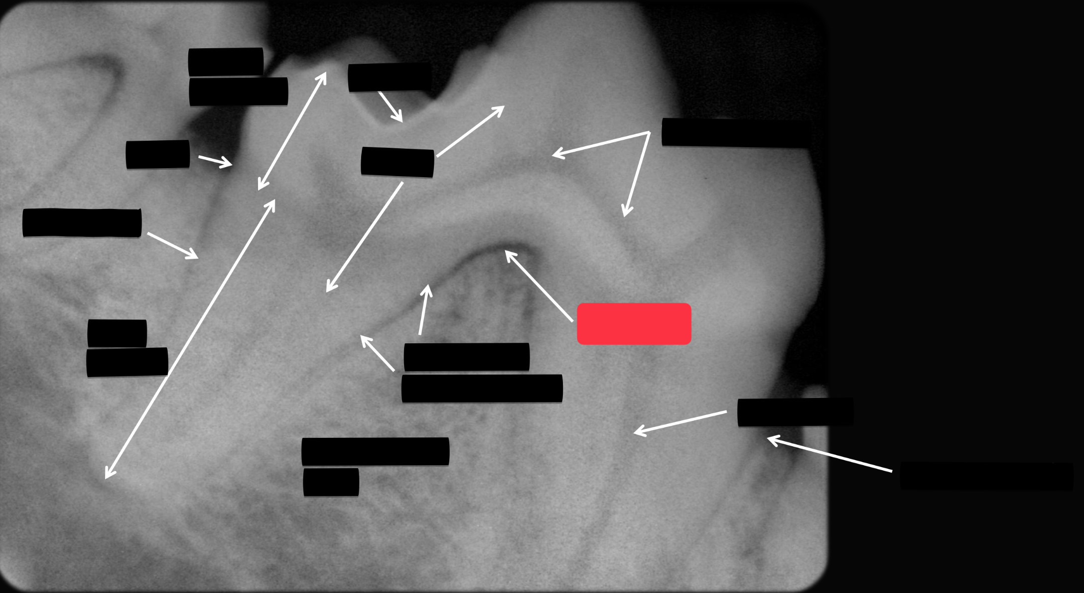 <p>Label this part of the tooth.</p>