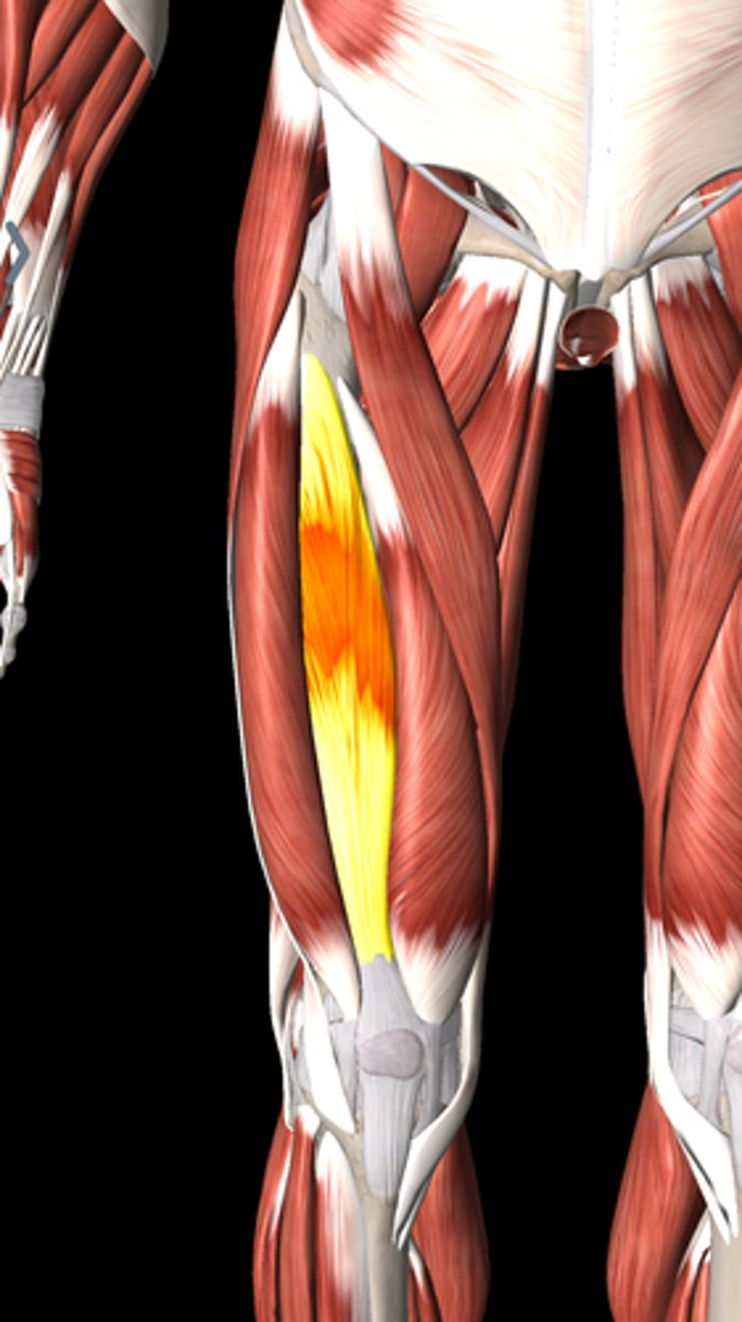 <p>What is this and what does it do? Give an origin and insertion.</p>