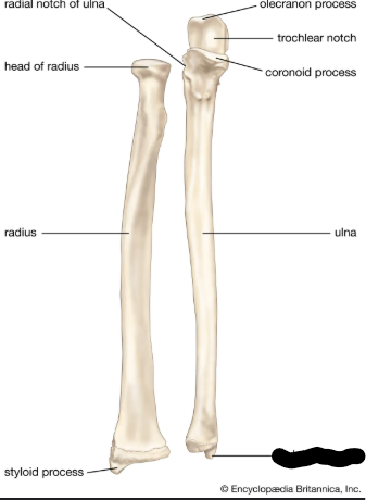 <p>What bone landmark is this within the <strong>Ulna</strong></p><ul><li><p>Medial Forarm Bone; Antebrachial, Ulnar Region)</p></li></ul><p></p>