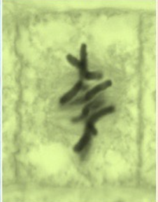 <p>During <strong>_____</strong>, the cell's chromosomes align perfectly along the center of the cell.</p>