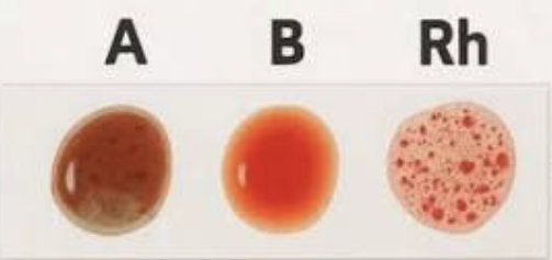 <p>what blood type is this? </p>