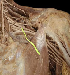 <p>Identify the structure</p>