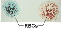 <p>What type of blood is this?</p>