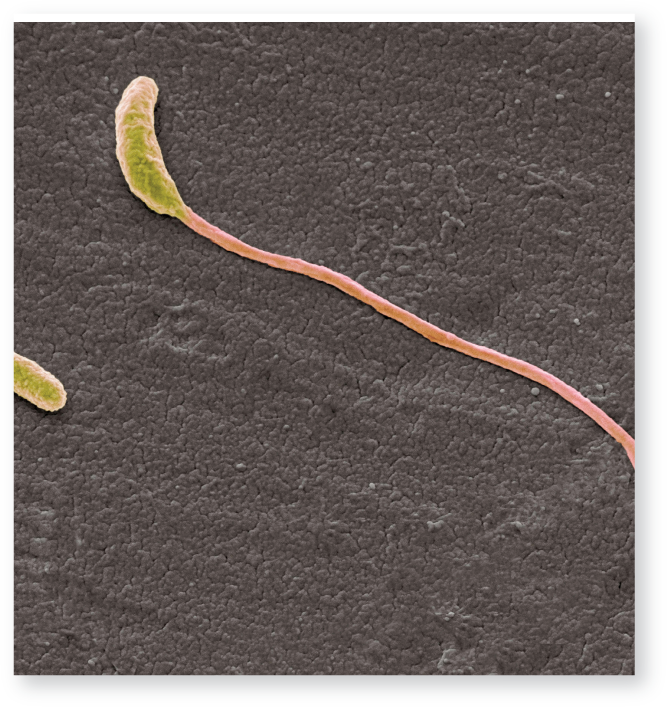 <p>a microorganism that has<strong> one </strong>flagellum at one end</p>