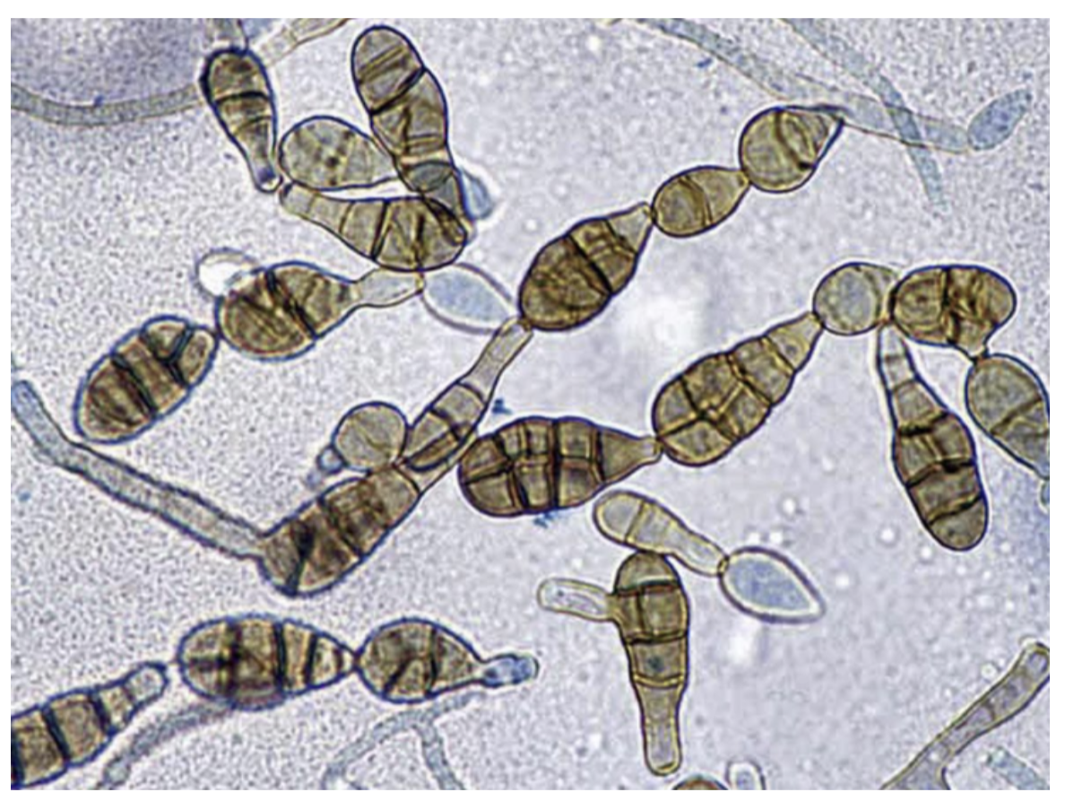 <p>-Dematiaceous mold</p><p>-Brownish black colonies</p><p>-Chains of club-shaped conidia with transverse and longitudinal separations</p>