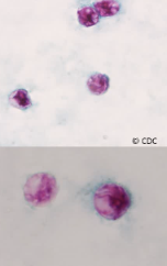 <p>Cyclospora cayetanensis: Oocyst</p>