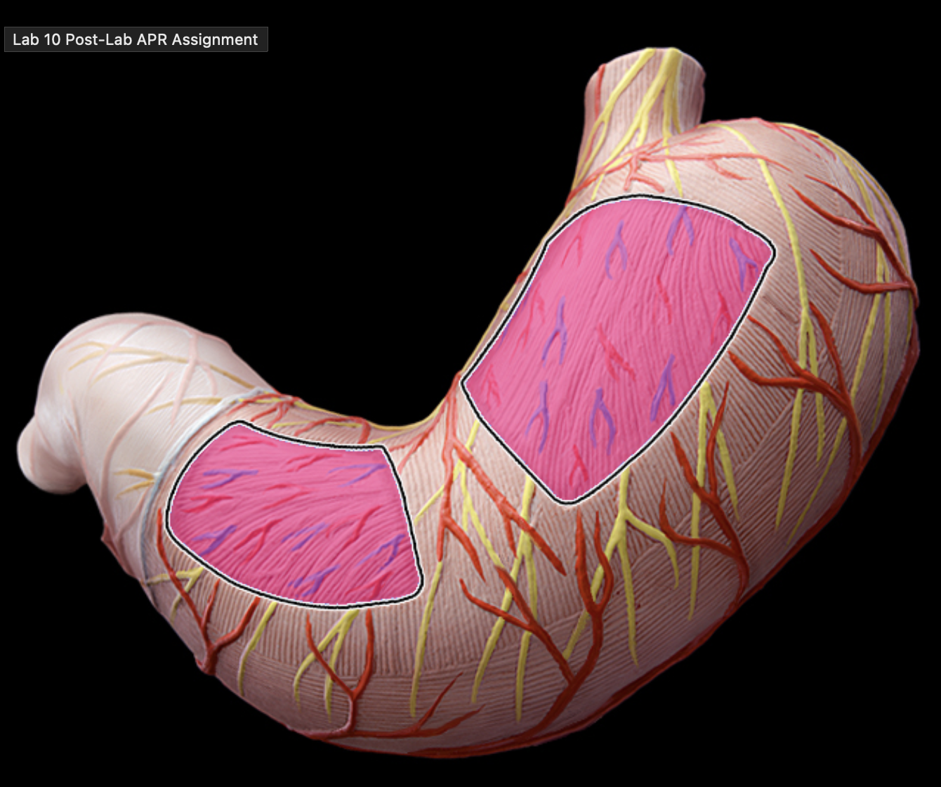 <p>Inner oblique layer</p>