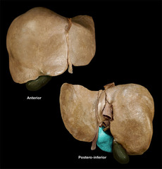 <p>Identify the structure</p>