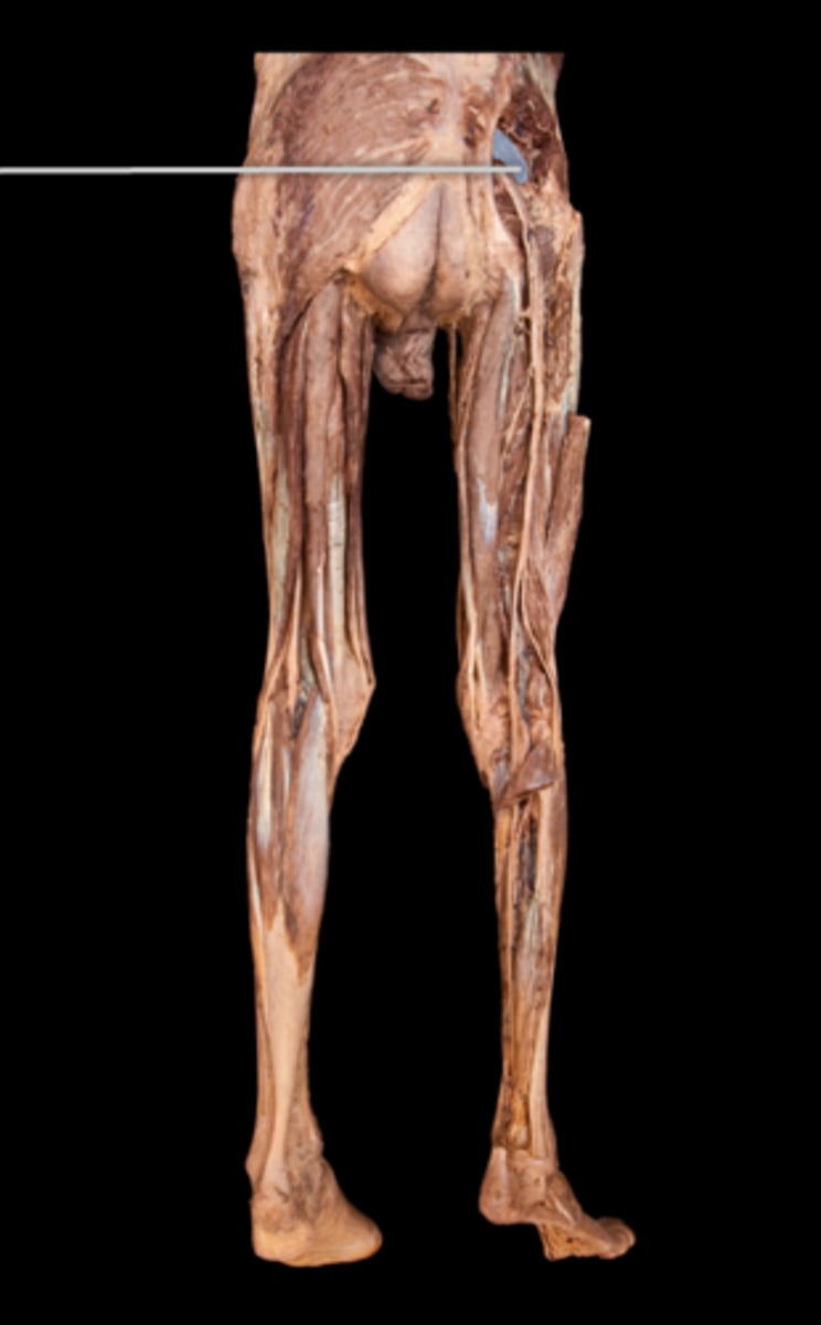 <p>What muscle is this?</p>