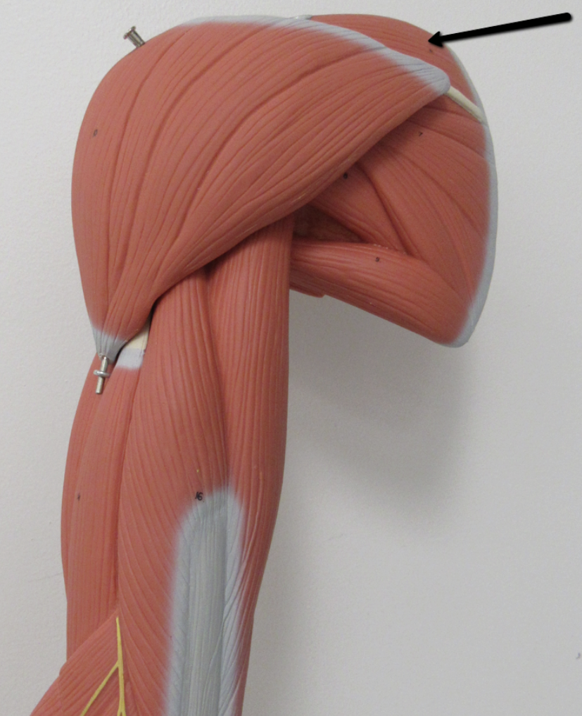 <p>Identify the muscle indicated by the pointer.</p>