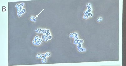 <p>What is this organism?</p>