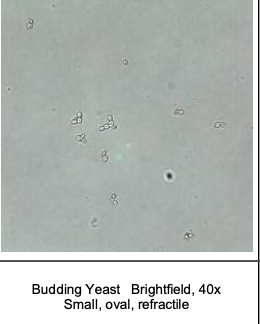<p>yeast</p><ul><li><p>remember that they look like rbcs, but they clump together</p></li></ul><p></p>