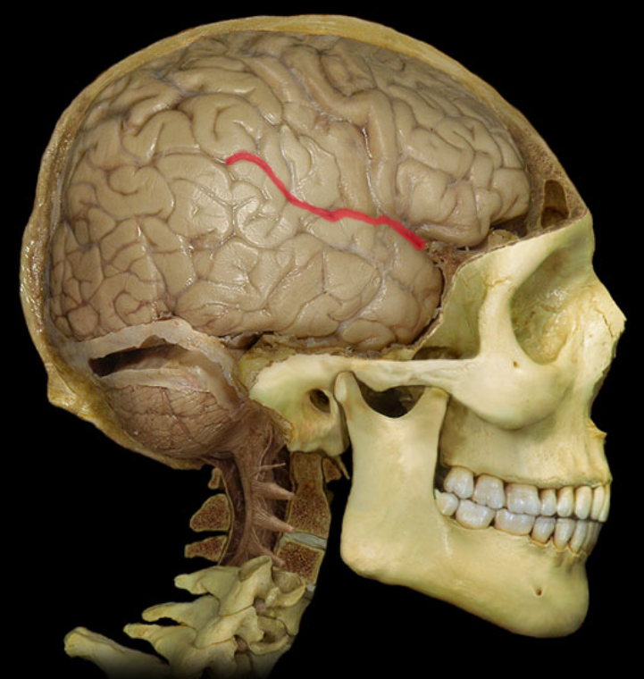 term image