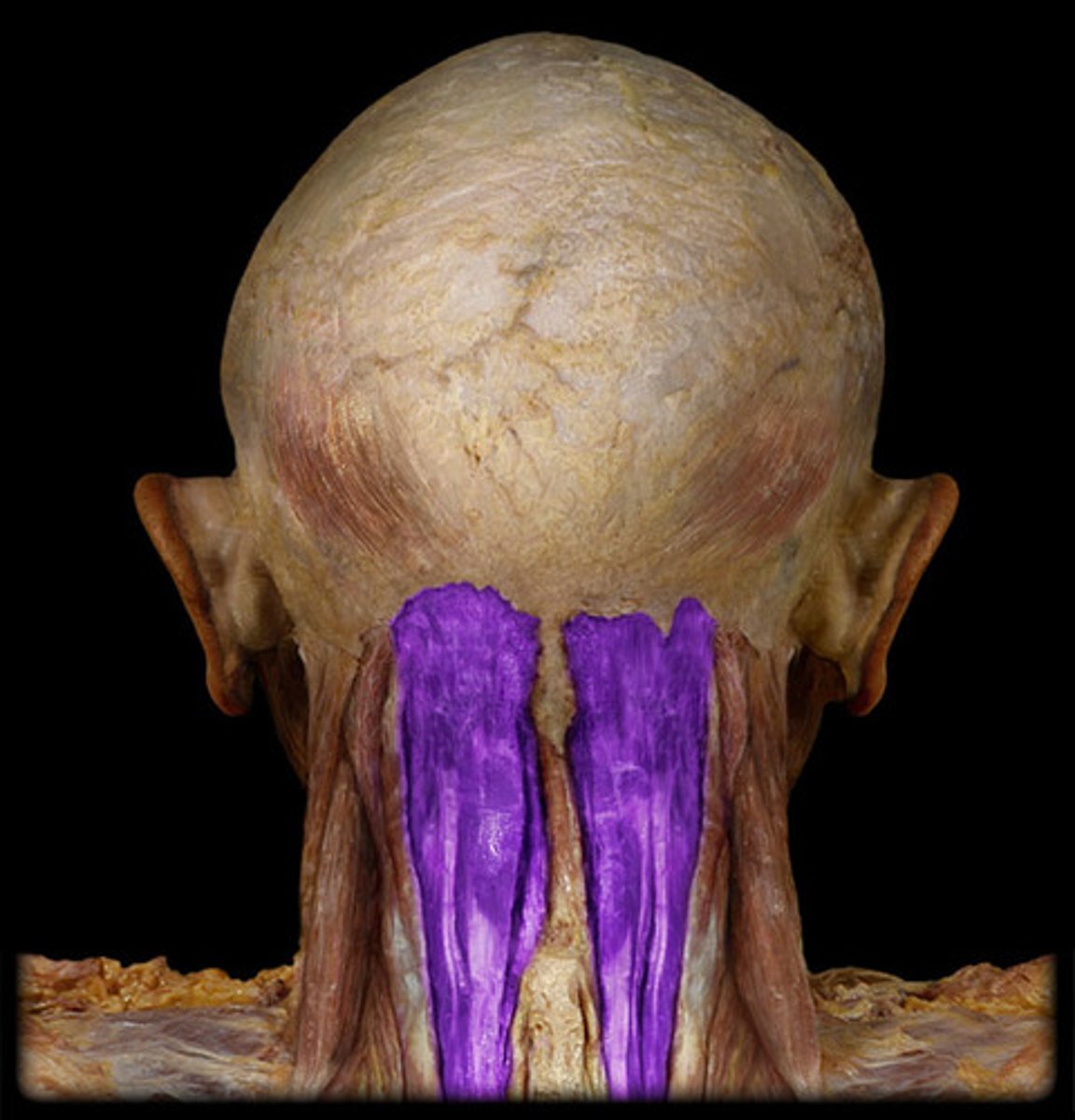 <p>Region:</p><p>Neck</p><p>Action:</p><p>Extends head</p><p>Innervation:</p><p>Cervical nerves</p>