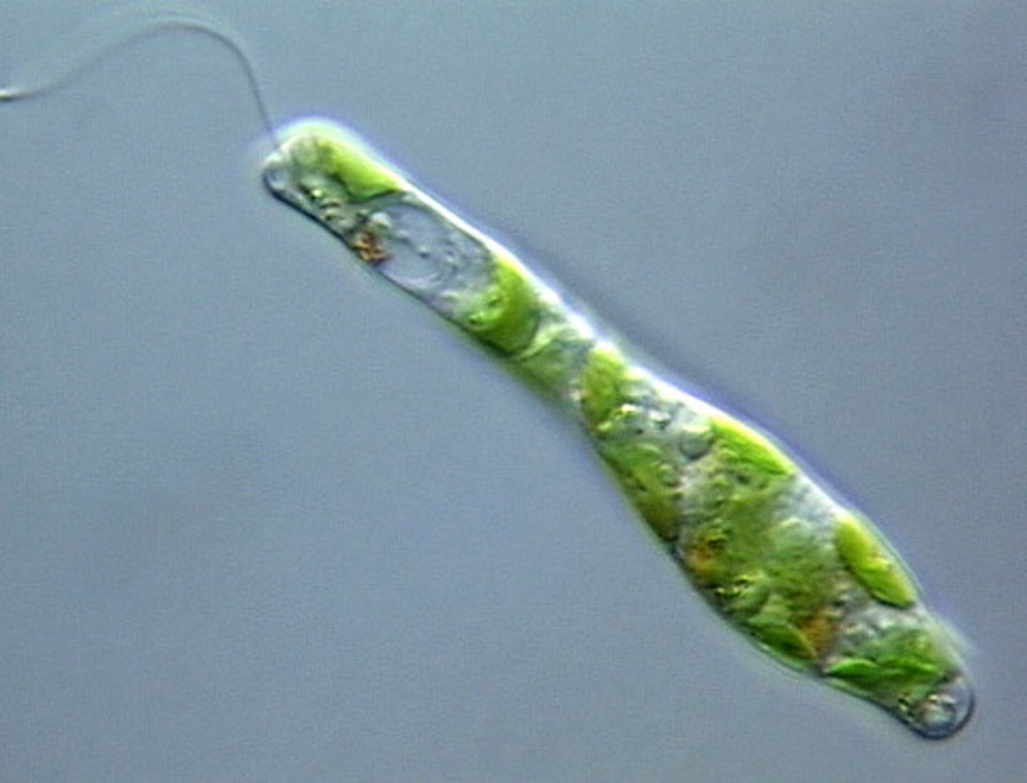 <p>Crystalline rod flagellum</p>