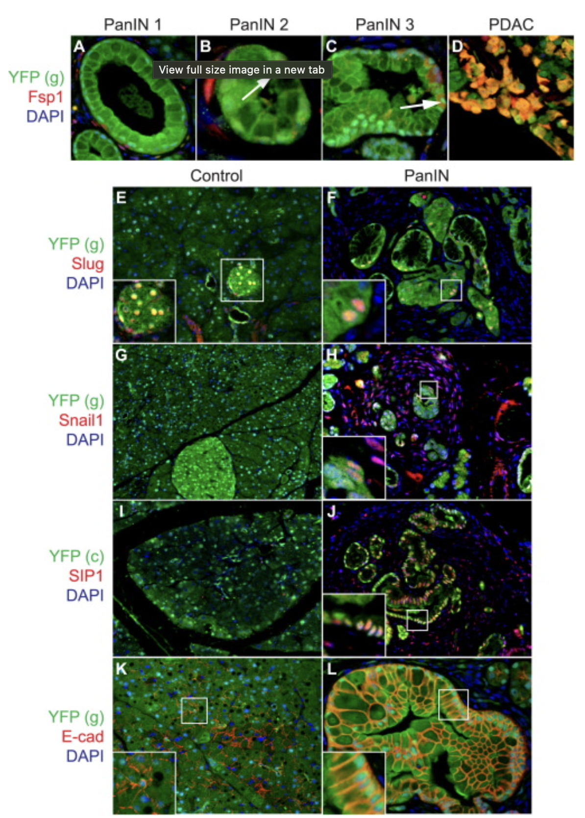<p>What is FSP1 a marker of?</p>
