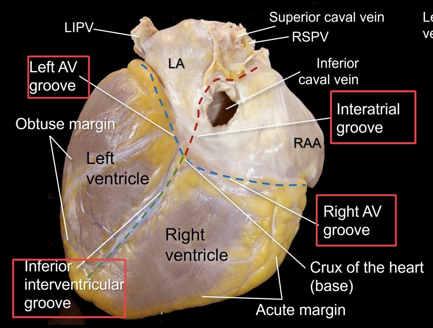 <p>separates the left and right atria</p>