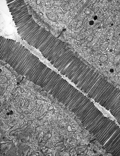 <p>Microvilli</p>