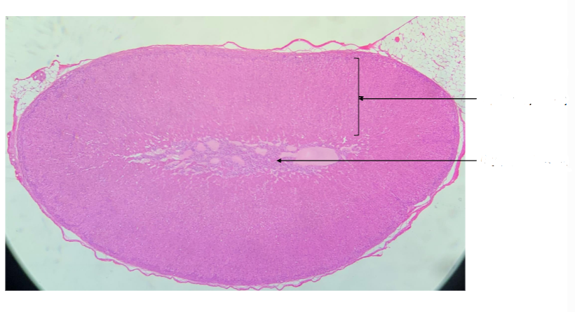 <p>what gland is this? </p>