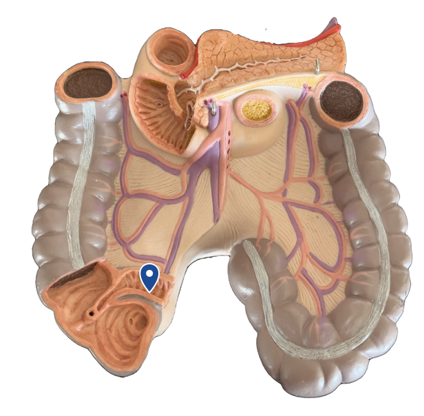 <p>Name this segment of the small intestine.</p>