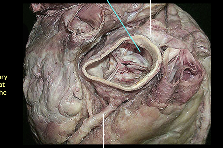 <p>What is the bottom white line pointing to?</p>