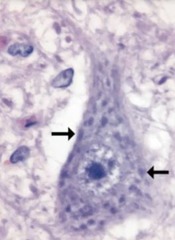<p>- Rough endoplasmic reticulum in neuron</p><p>*Darker dots in cytoplasm of neuron</p>
