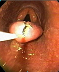 <p>What is this treatment for?</p>