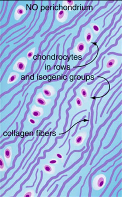 <ul><li><p>mixture of dense fibrous connective tissue and hyaline cartilage.</p></li><li><p>contains a mixture of type I and II collagen fibers.</p></li><li><p>contains a mixture of fibroblasts and chondrocytes.</p></li><li><p>chondrocytes are either isolated or form linear isogenous groups (as opposed to the oval-shaped isogenous groups in hyaline and elastic cartilages).</p></li></ul><p></p>