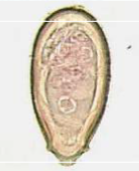 <p>What egg is this?</p>