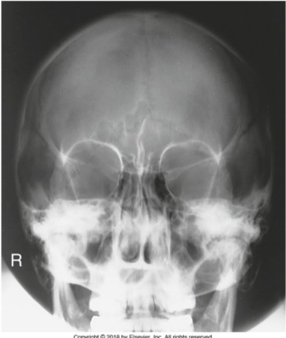<p><span><span>The radiograph shown is</span></span></p>