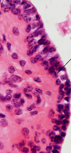 <p>soort epitheel</p>