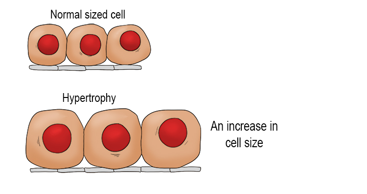 An increase in the size of cells.