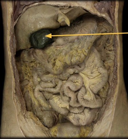 <p>Accessory organs of digestion- Gallbladder</p>