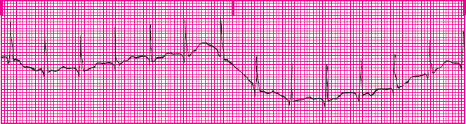 <p>What rhythm is this?</p>