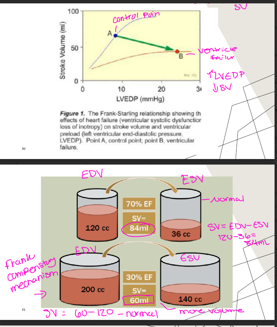 <p>increase in LVEDP leads to stronger contraction and greater SV</p><p>(when systolic function or contractility decreases in DCM the volume and the LVEDP will increase to help maintain that SV)</p><p>-point A normal, normal pressures, normal SV</p><ul><li><p>point B shows a decrease in EF, if pressures and volumes arent increase the SV is very reduce and thats what point B is showing</p></li><li><p>point C shows a pt with cardiac remodeling done by increaing the pressures and volumes, the SV will increase for a little bit, mechanism works but eventually fails</p></li></ul><p></p>