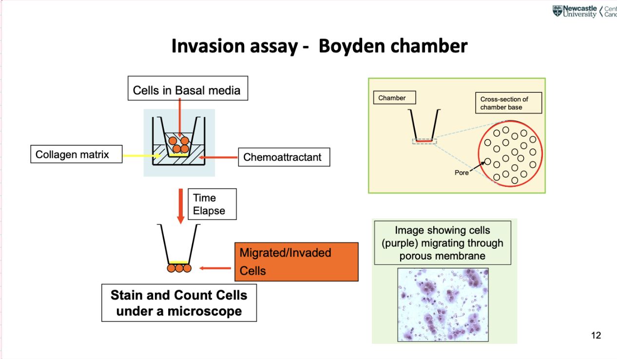 <p><span style="background-color: inherit; line-height: 22px; color: windowtext;">Boyden chamber- well of tissue culture disc, insert a chamber that fits into well, bottom part has small holes (smaller than a cell), cells squeeze themselves through to enter well below</span><span style="line-height: 22px; color: windowtext;"> </span></p><ul><li><p class="Paragraph SCXO81521864 BCX0" style="text-align: left;"><span style="background-color: inherit; line-height: 22px; color: windowtext;">Chemoattractant in bottom of chamber attracts cancer cells</span><span style="line-height: 22px; color: windowtext;"> </span></p></li><li><p class="Paragraph SCXO81521864 BCX0" style="text-align: left;"><span style="background-color: inherit; line-height: 22px; color: windowtext;">Measure motility to some extent</span><span style="line-height: 22px; color: windowtext;"> </span></p></li><li><p class="Paragraph SCXO81521864 BCX0" style="text-align: left;"><span style="background-color: inherit; line-height: 22px; color: windowtext;">Can put collagen matrix at bottom of chamber- a barrier for cancer cells to cross, in order for them to cross they need to digest using proteases </span><span style="line-height: 22px; color: windowtext;"> </span></p></li><li><p class="Paragraph SCXO81521864 BCX0" style="text-align: left;"><span style="background-color: inherit; line-height: 22px; color: windowtext;">Take bottom part if chamber and stain it- darker areas in image are cancer cells, smaller than pores, but can squeeze through, can change shape and size to be motile and invasive </span><span style="line-height: 22px; color: windowtext;"> </span></p></li></ul><p></p>