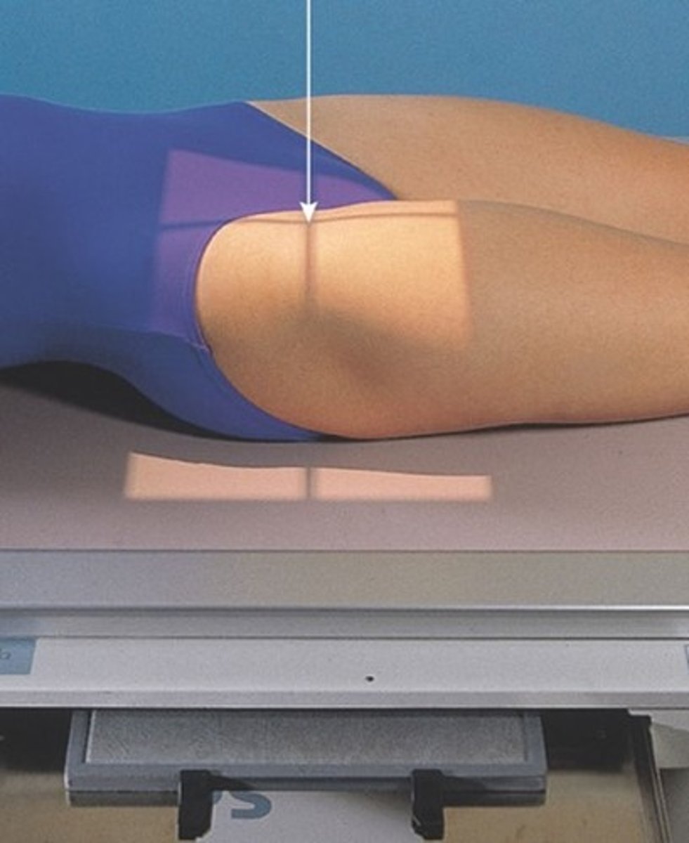 <p>S - outside of light</p><p>T - 25 mAs @ 75 kVp</p><p>A - none</p><p>M - correct marker in top corner</p><p>P - PT supine w/ toes TP, CR 2" in & 4" down from ASIS</p><p>S - 40"</p><p>B - suspension</p><p>C - 10 x 12 lengthwise</p>