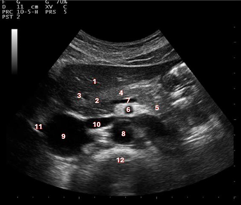 <p>What structure/vessel is indicated by #6?</p>