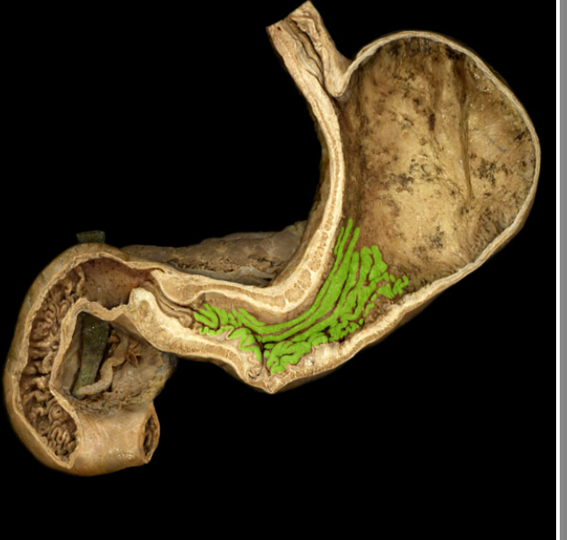 <p><span>Gastric folds</span></p>