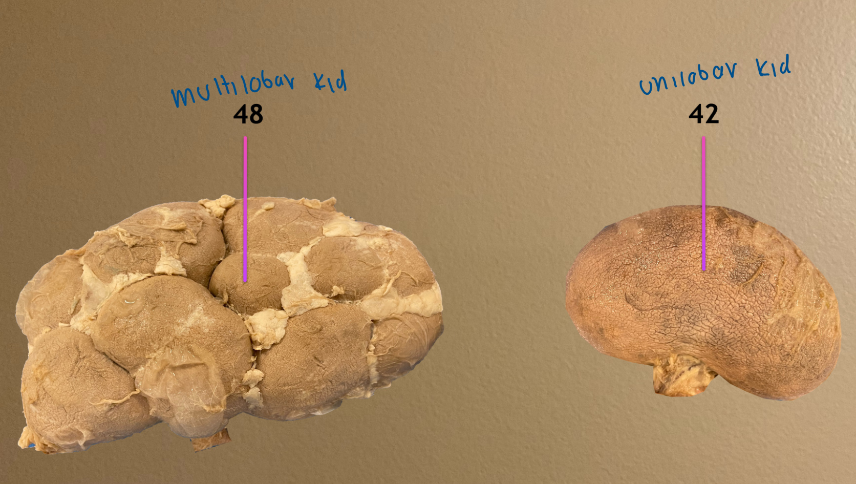 <ol start="42"><li><p>unilobar kidney: small ruminant </p></li></ol><ol start="48"><li><p>multilobar kidney: in cows </p></li></ol><p></p>