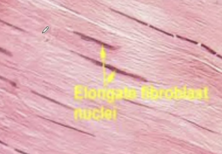 <p>Example of regular ct</p>