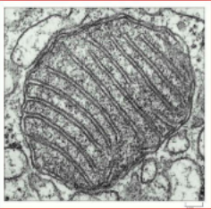 <p>An advanced imaging tool that passes a beam of electrons through an ultra-thinly sliced specimen to view its internal structures at a nanometer or atomic scale</p><ul><li><p><span>show fine detail within cells</span></p></li></ul><p></p>