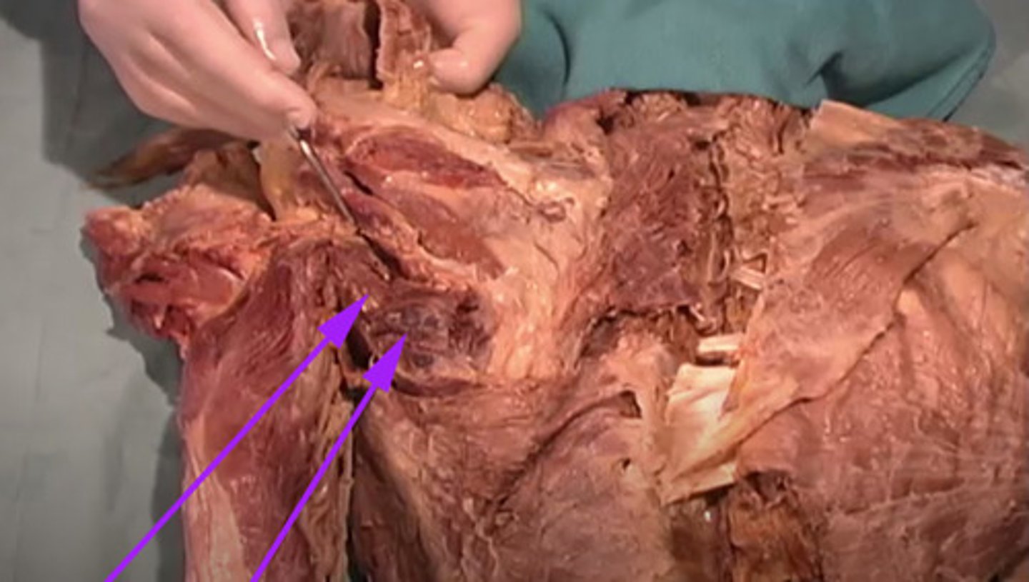 <p>What is the name of this muscle as indicated by the arrow?</p>