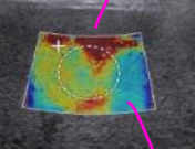 <p>List the <strong>4 GE liver fibrosis staging categories</strong> with m/s.</p><ul><li><p>Normal–mild: </p></li><li><p>Mild–moderate: </p></li><li><p>Moderate–severe: </p></li><li><p>Cirrhosis: </p></li></ul><p>what does red mean and what does blue mean?</p>