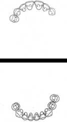 <p>What kennedy classification?</p>