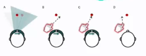 <p>A treatment for hemineglect, making use of glasses that force the eyes to focus at a different angle than attempted, causing a temporary reduction in symptoms</p>